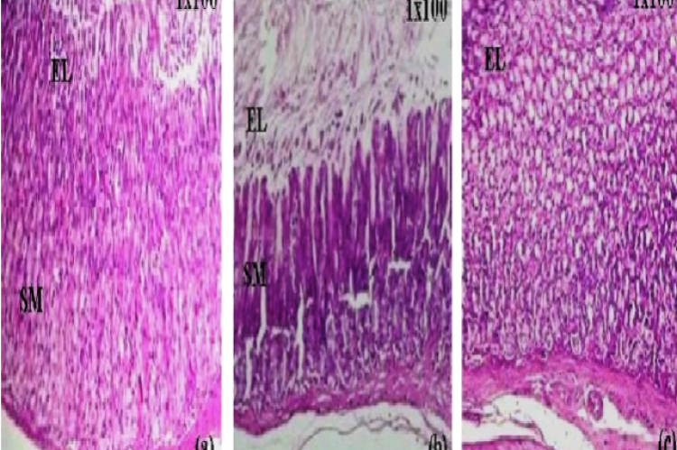 Effect of Herbo-mineral formulation on histopathology of stomach in ethanol induced acute gastric ulcer