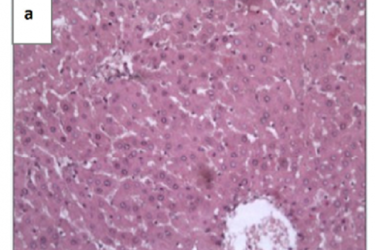 Histological figues of liver sections of rats teated with