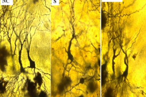 Photomicrographs of Hippocamal CA3 neurons (Golgi staining)