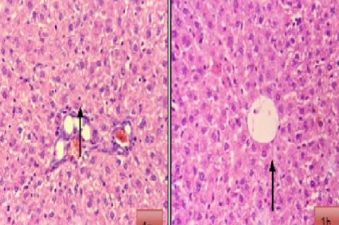 [Normal control] shows liver parenchyma with intact architecture